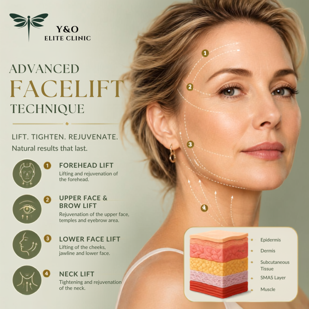 Advanced System Facelift